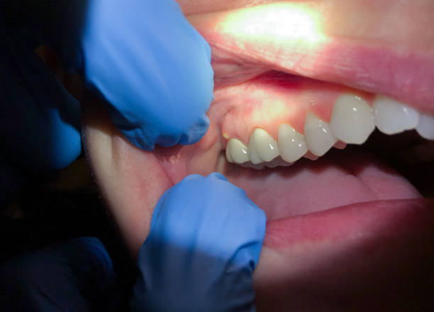 Best Emergency Treatment for Toothache in Chesterton, IN